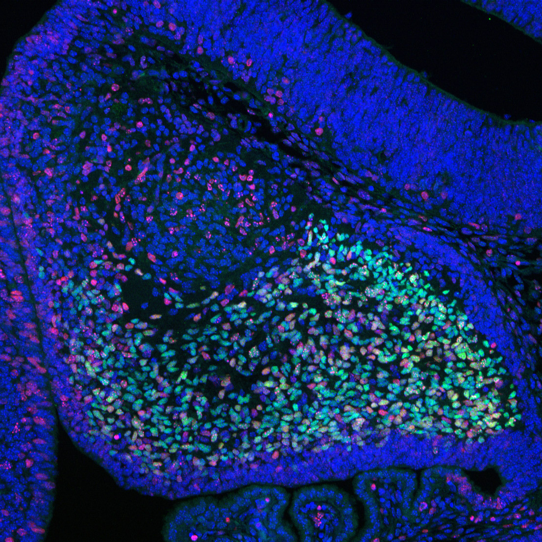 Neurons and cell nuclei in the developing cerebellum of a mouse embryo
