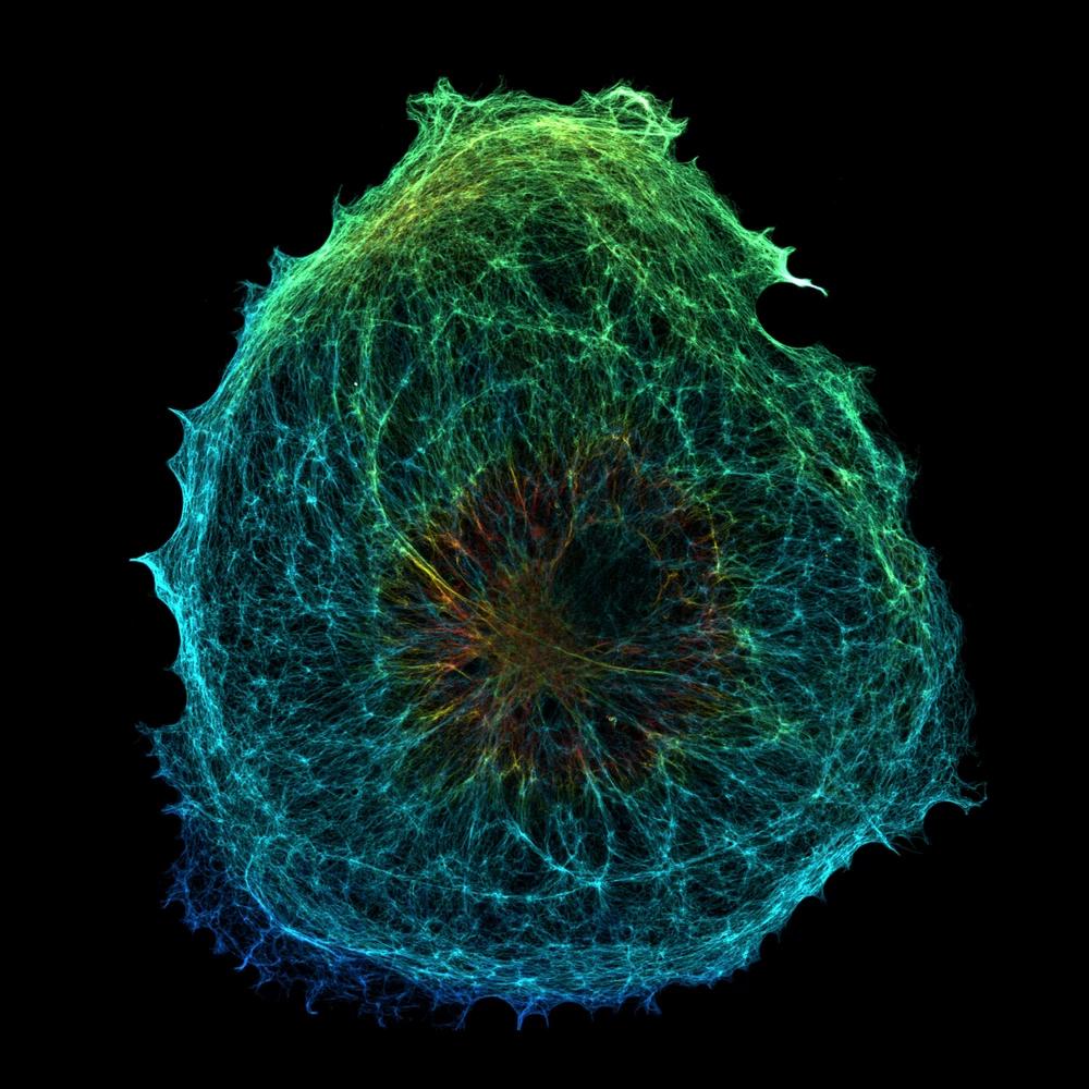 Vimentin filaments in a cell, visualized by fluorescence microscopy
