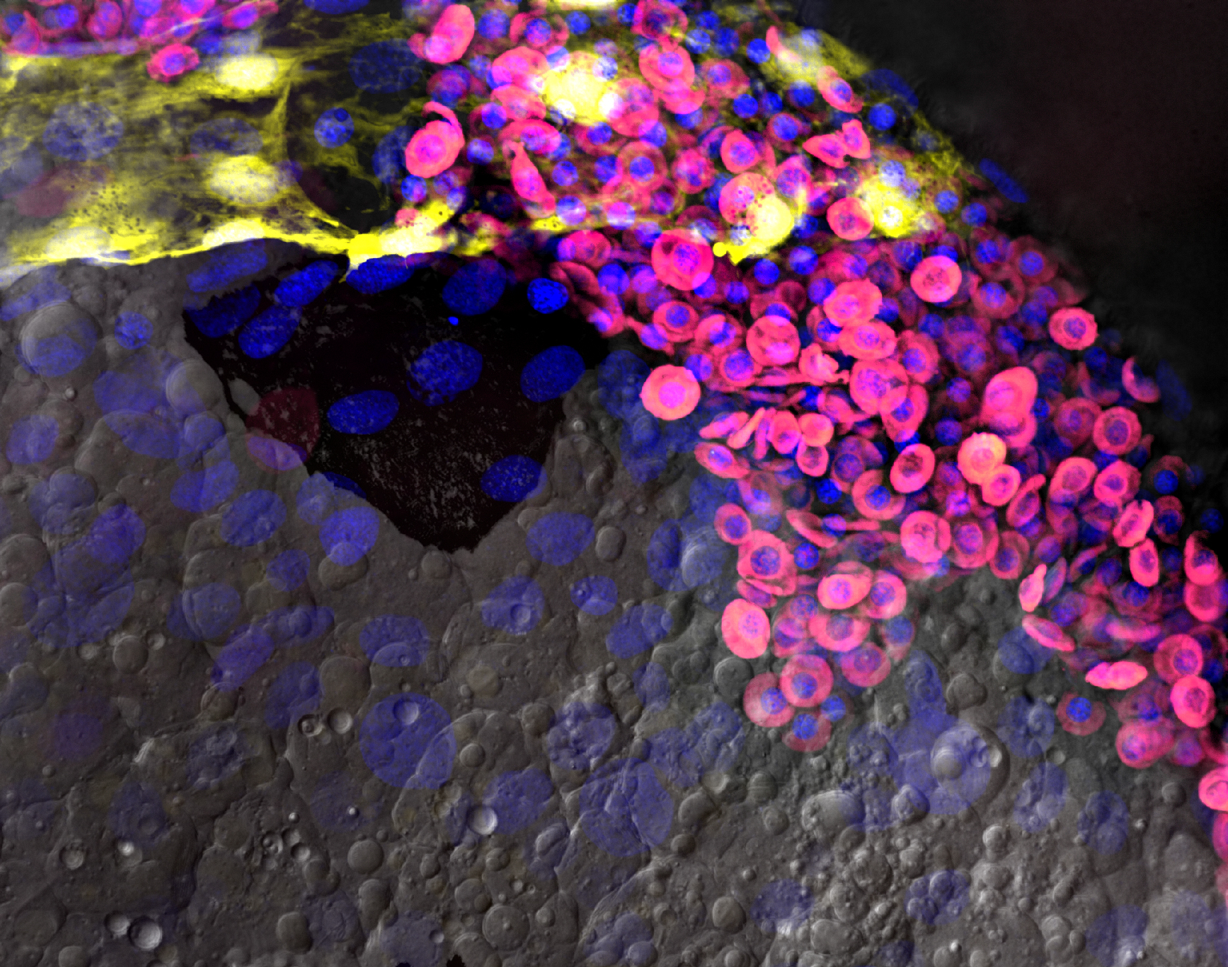 Blood cells and vessels on the yolk of a two-day-old zebrafish embryo